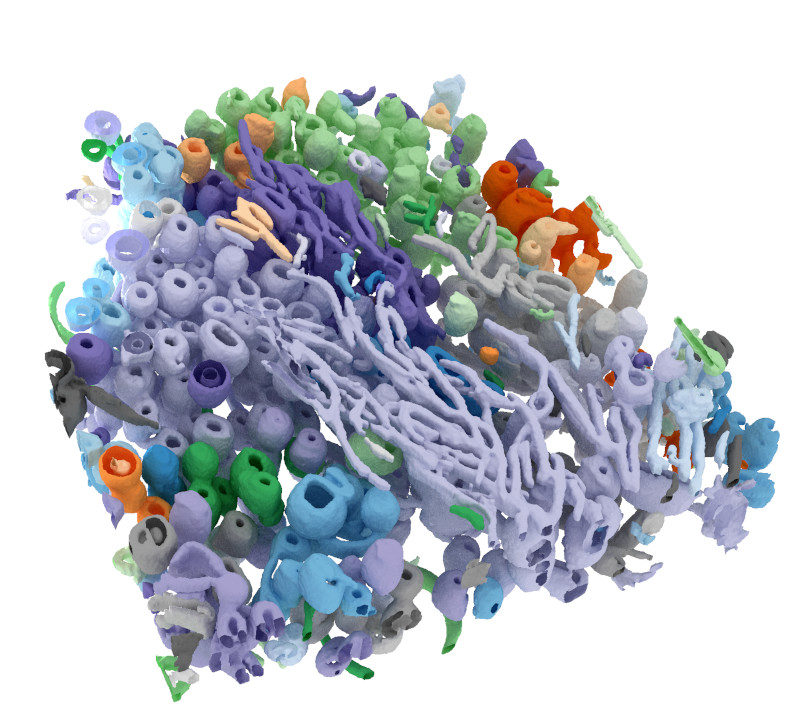 Surface reconstruction of a cryo-soft x-ray tomogram using deep learning.